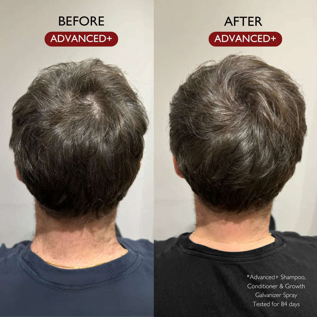 ADVANCED+ HAIR GROWTH GALVANIZER