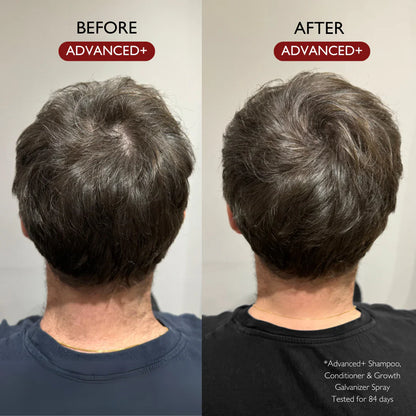 ADVANCED+ HAIR GROWTH GALVANIZER